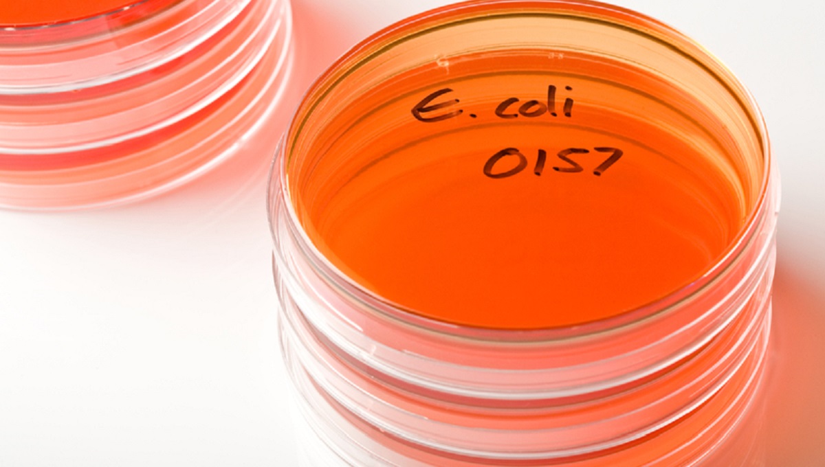 Petri Dish marked as E.coli O157