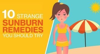 10 Strange Sunburn Remedies You Should Try